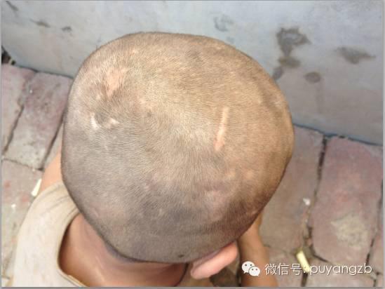 河南7岁男童被曝遭虐待与猪共处 至今不会说话