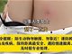 女子在景区摸马肚子被狠狠咬一口